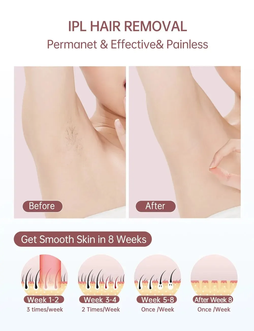 Laser Hair Removal Device Ice Cooling Permanent Painless